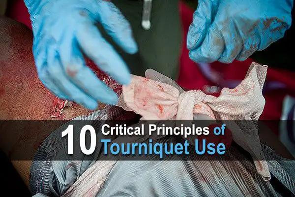 10 Critical Principles Of Tourniquet Use