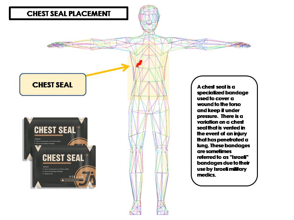 CHEST SEAL PLACEMENT