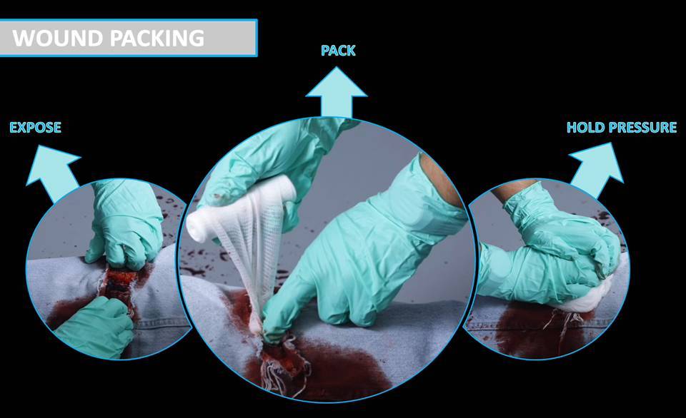 WOUND PACKING