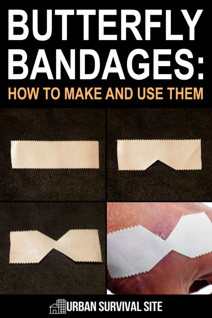 Butterfly Bandages How To Make And Use Them Urban Survival Site   Butterfly Bandages How To Make And Use Them Pin 1 683x1024 