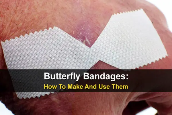 Butterfly Bandages: How To Make and Use Them