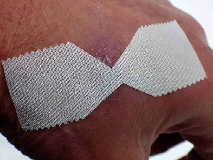 DIY Butterfly Bandage Applied