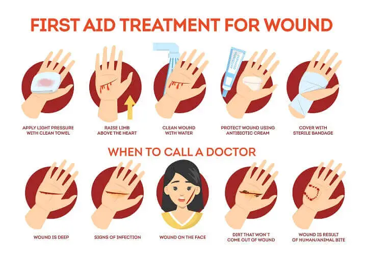 First Aid Treatment for Wound