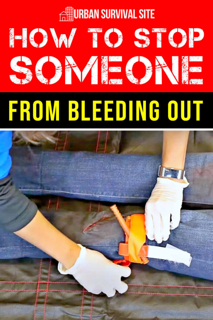 How to Stop Someone from Bleeding Out