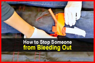 How to Stop Someone from Bleeding Out
