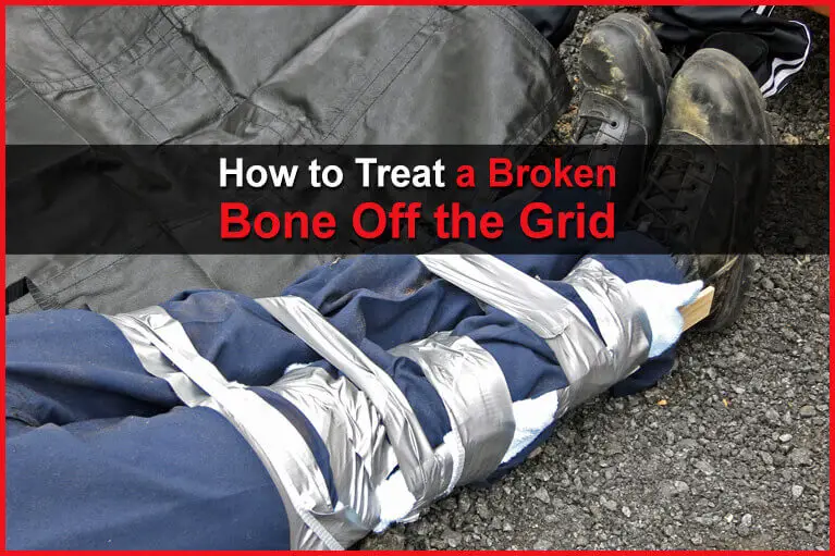 How to Treat a Broken Bone Off the Grid