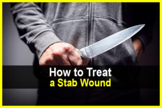How to Treat a Stab Wound