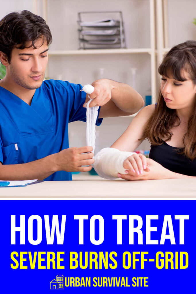 How to Treat Severe Burns Off-Grid