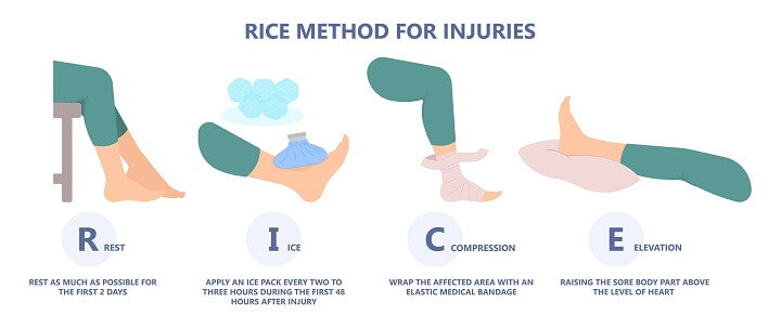 RICE Method for Injuries
