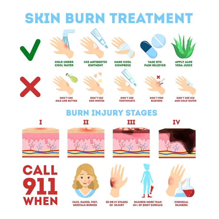Skin Burn Treatment