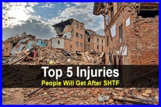 Top 5 Injuries People Will Get After The SHTF