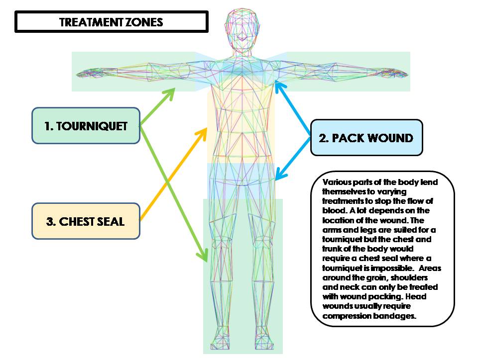 TREATMENT ZONES